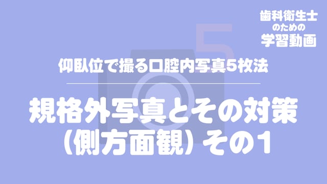 12.規格外写真とその対策（側方面観）その１