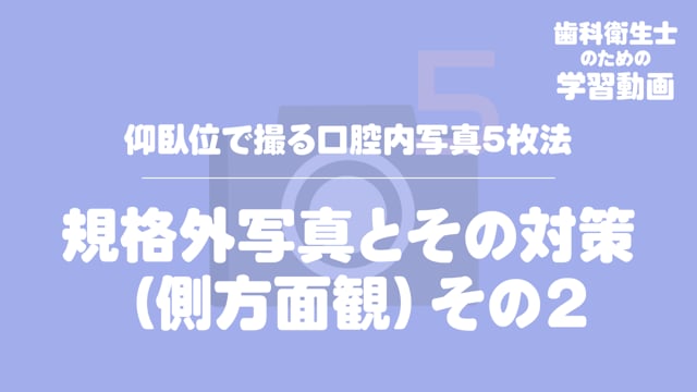 13.規格外写真とその対策（側方面観）その２