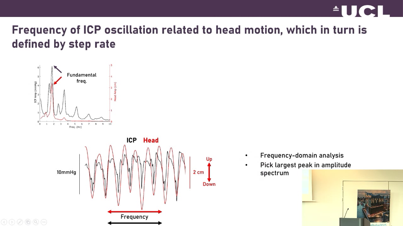 S19. Gabriel Mendes - Cut-off point of the noninvasive measurement of intracranial compliance for the diagnosis of idiopathic No