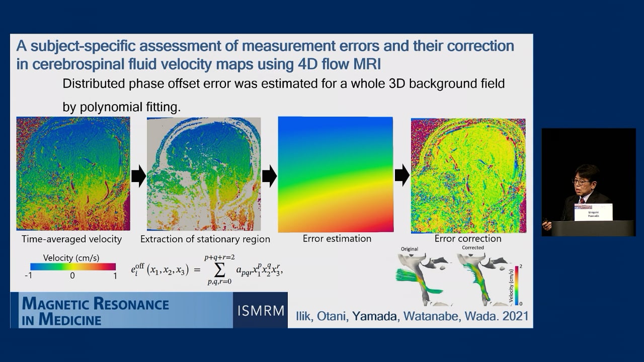 S12. Shigeki Yamada - Advances in 3D and 4D Imaging of Cerebrospinal Fluid and AI-Based Diagnosis of DESH