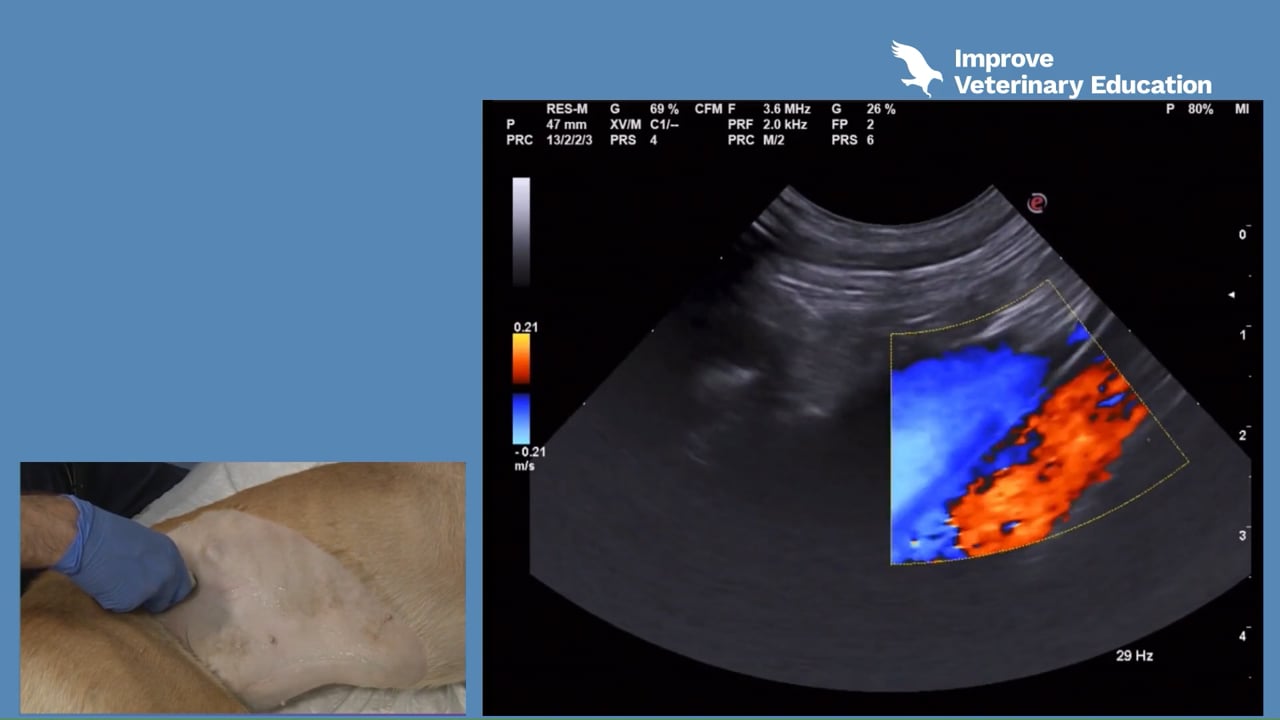 Doppler in the abdomen