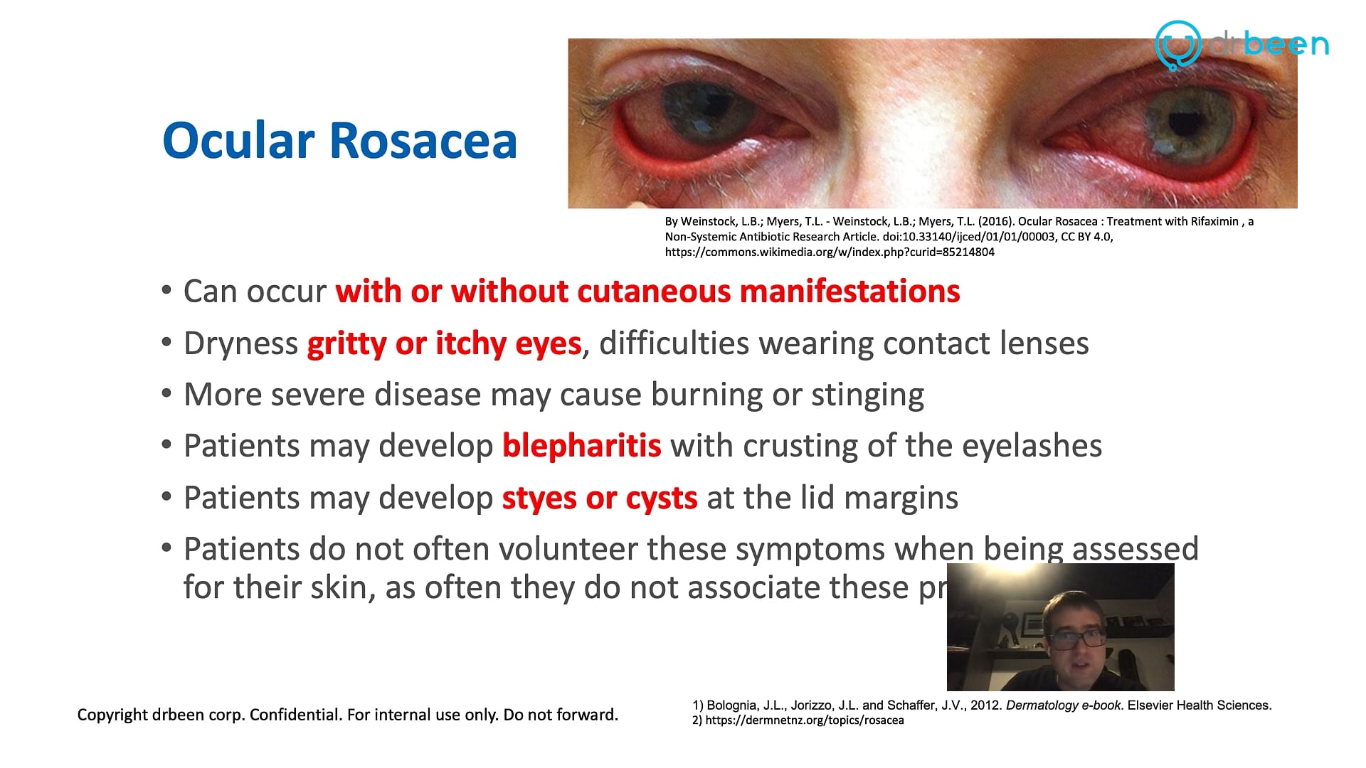 Rosacea (Dr. Thomas King)