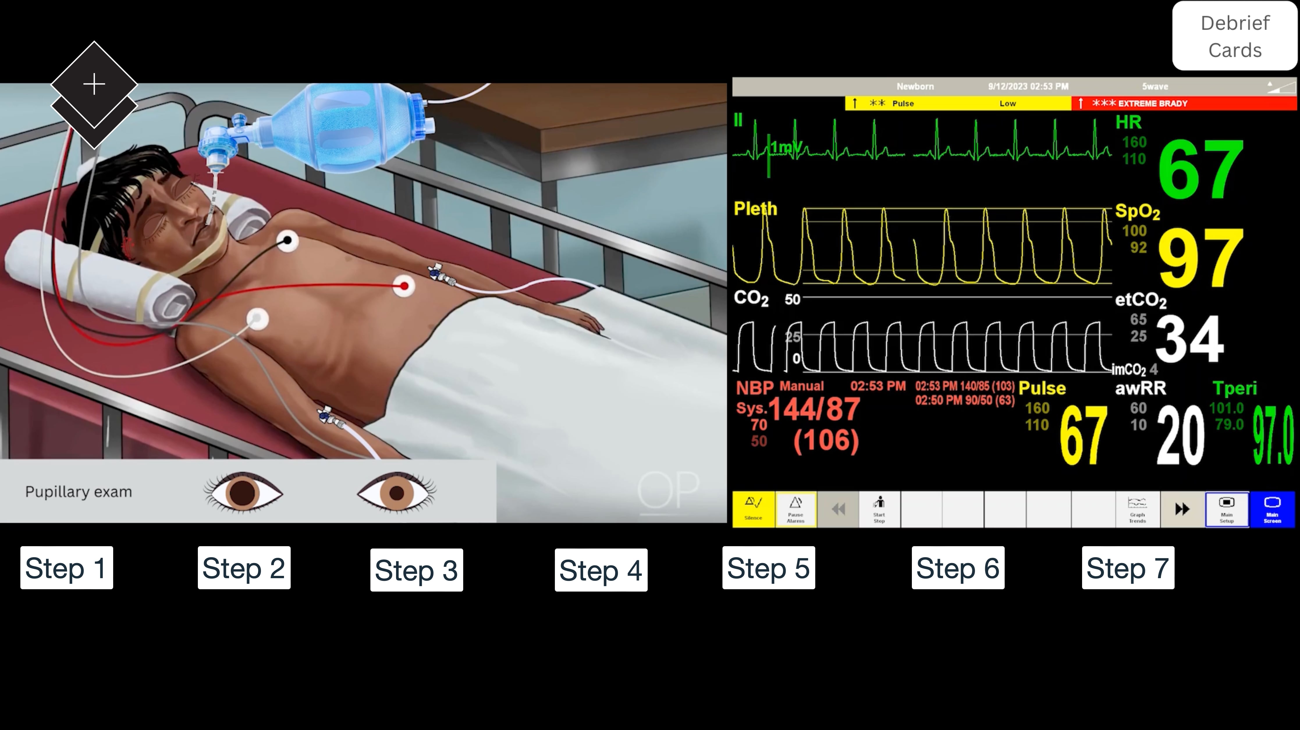 A Child with Severe Head Injury; A SimBox Interactive Video Simulation