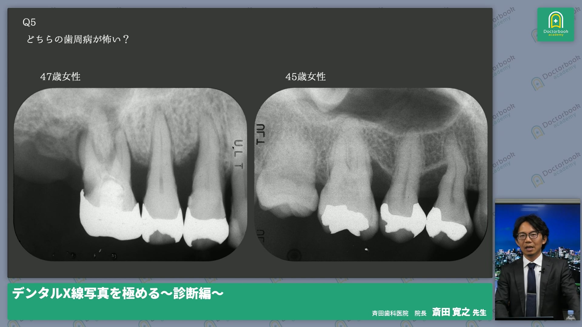 イントロダクション│デンタルクイズ～画像から見えること～