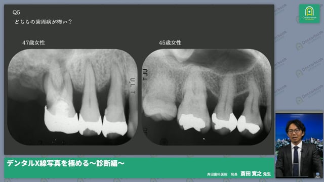 デンタルX線写真 ～撮る、読む、診るを極める～ 撮影編・診断編 