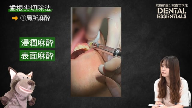 Step1：局所麻酔│Dental Essentials｜診療動画と写真で学ぶ vol.1 歯根尖切除術