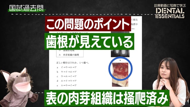 Step6：まとめ・国試過去問練習・解説│Dental Essentials｜診療動画と写真で学ぶ vol.1 歯根尖切除術