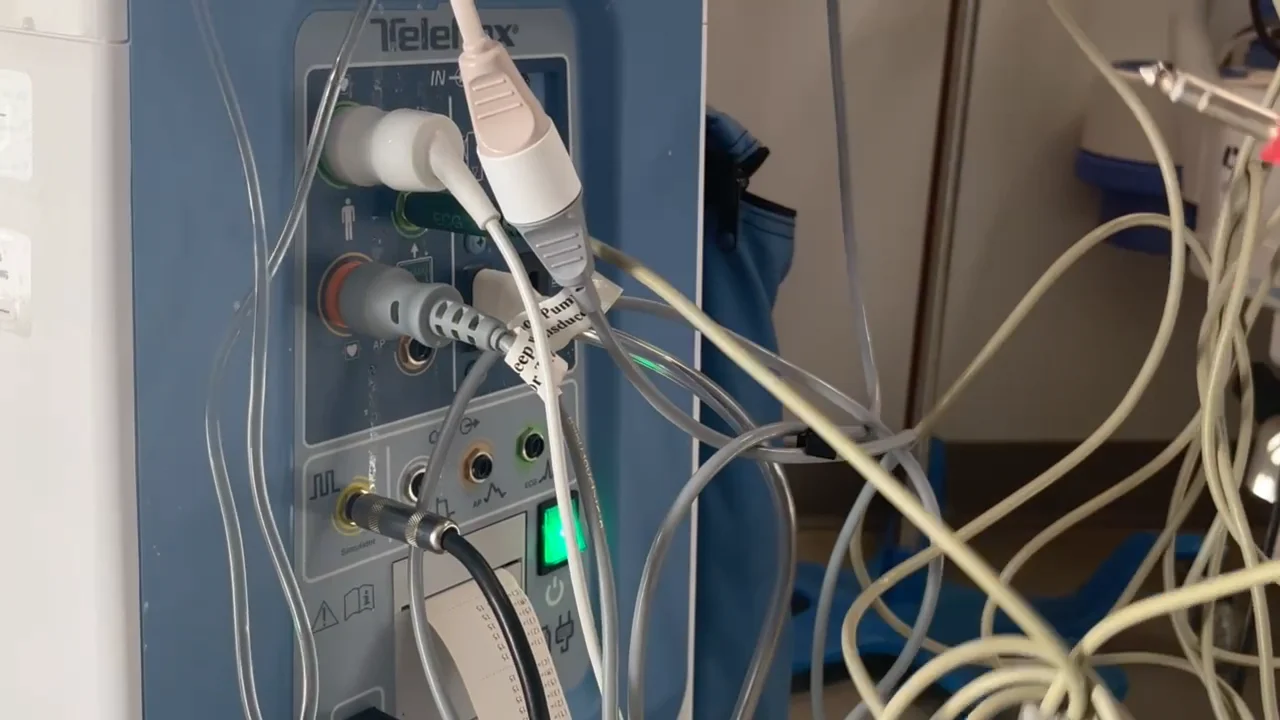 Non fiber optic IABP ICU set-up on Vimeo