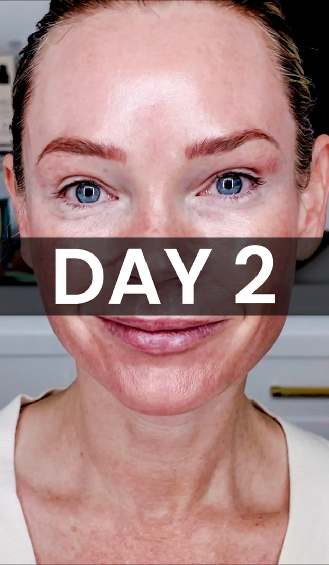 TCA Peel: Day 2 Progress video