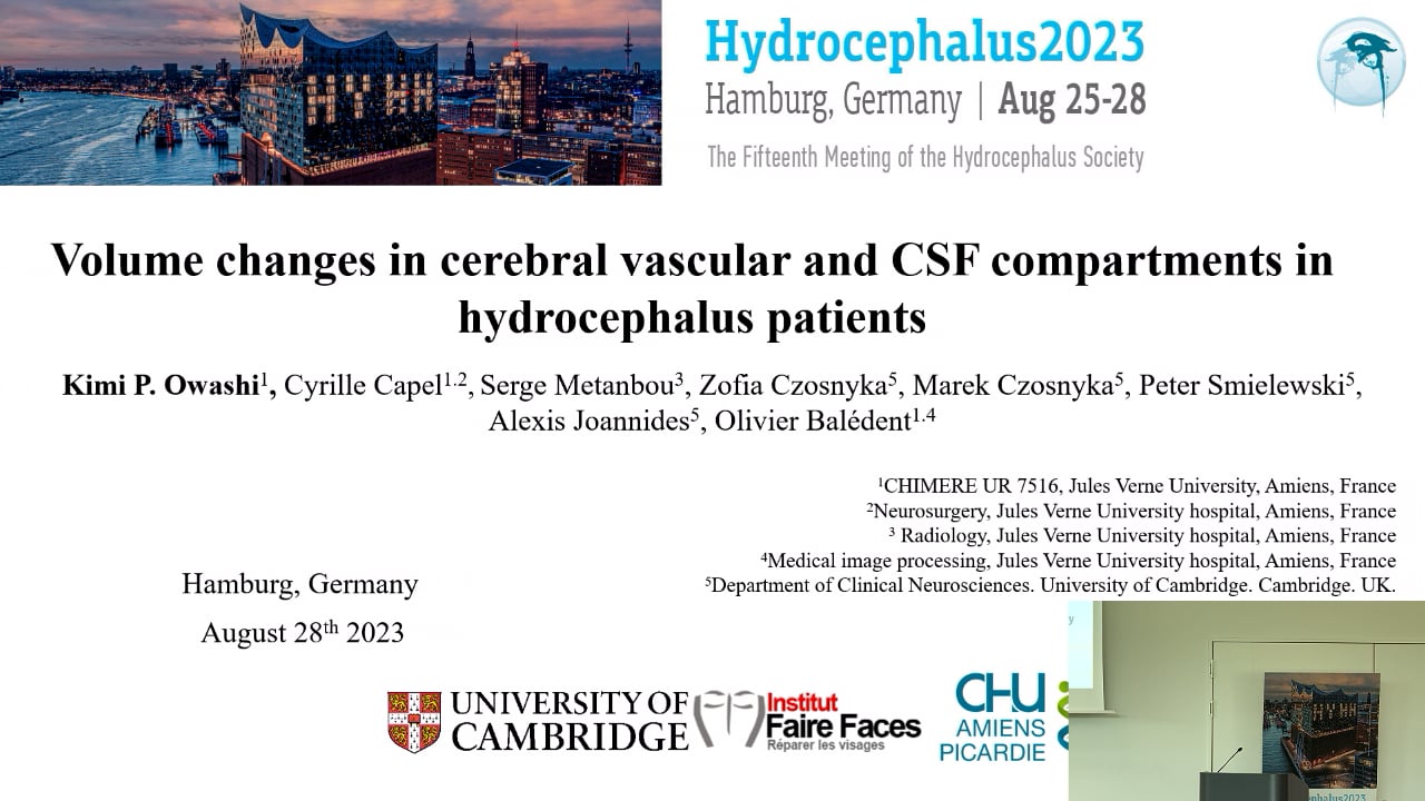 S31. Kimi Owashi - Volume changes in cerebral vascular and CSF compartments in hydrocephalus patients
