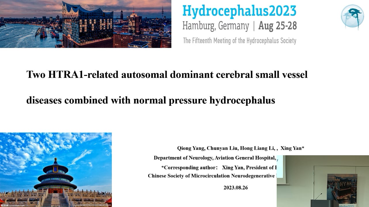 S31. Qiong Yang - Two HTRA1-related autosomal dominant cerebral small vessel disease combined normal pressure hydrocephalus