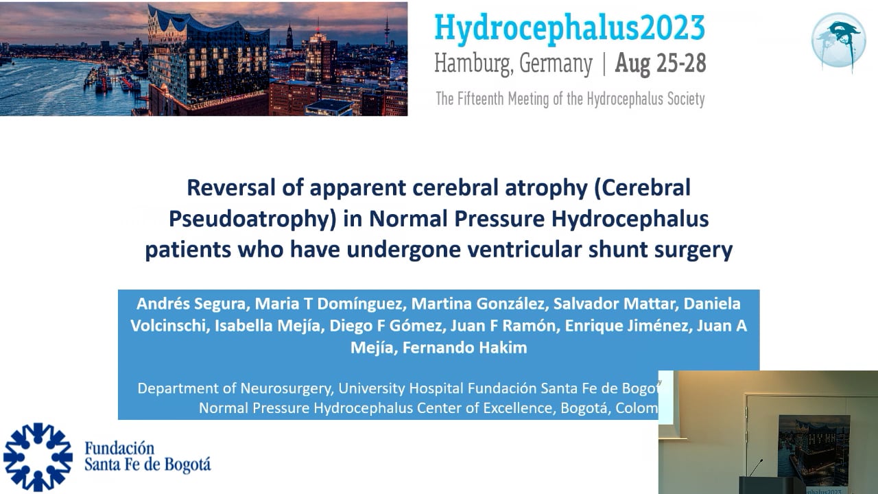 S22. Isabella Mejia Michelsen - Reversal of apparent cerebral atrophy,Cerebral Pseudoatrophy, in Normal Pressure Hydrocephalus p