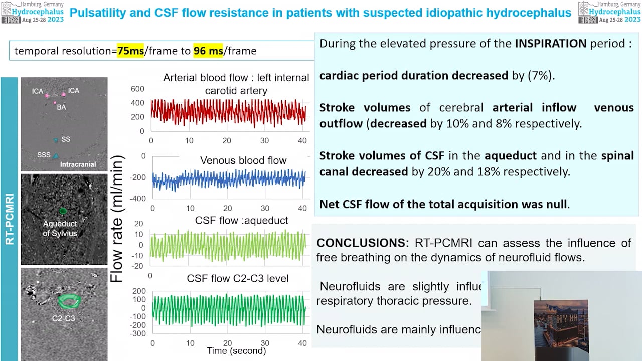 S32. Katharina Wolf - Monitoring patients with CSF disorders – potential use of phase-contrast MRI
