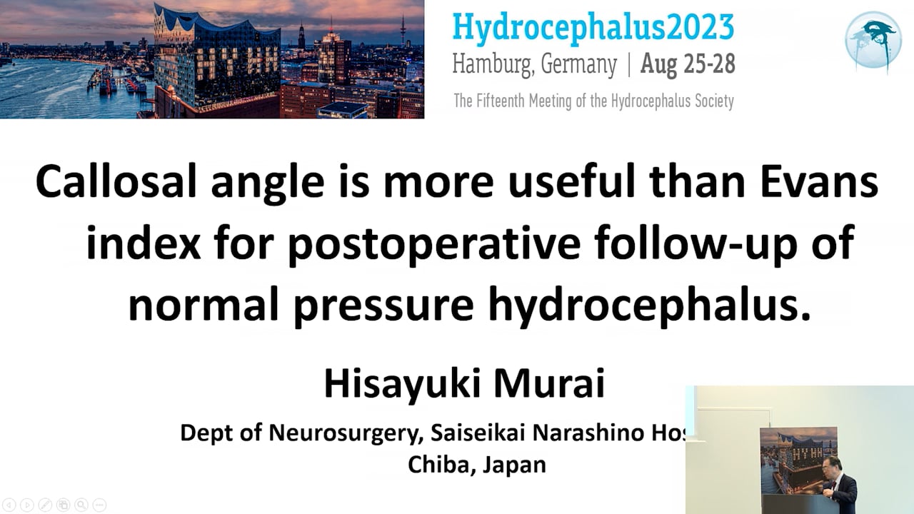 S29. Hisayuki Murai - Callosal angle is more useful than Evans index for postoperative follow-up of normal pressure hydrocephalu