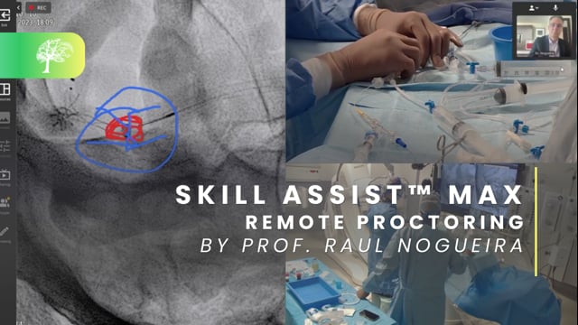 SKILL Assist™ MAX Remote Proctoring by Raul Nogueira