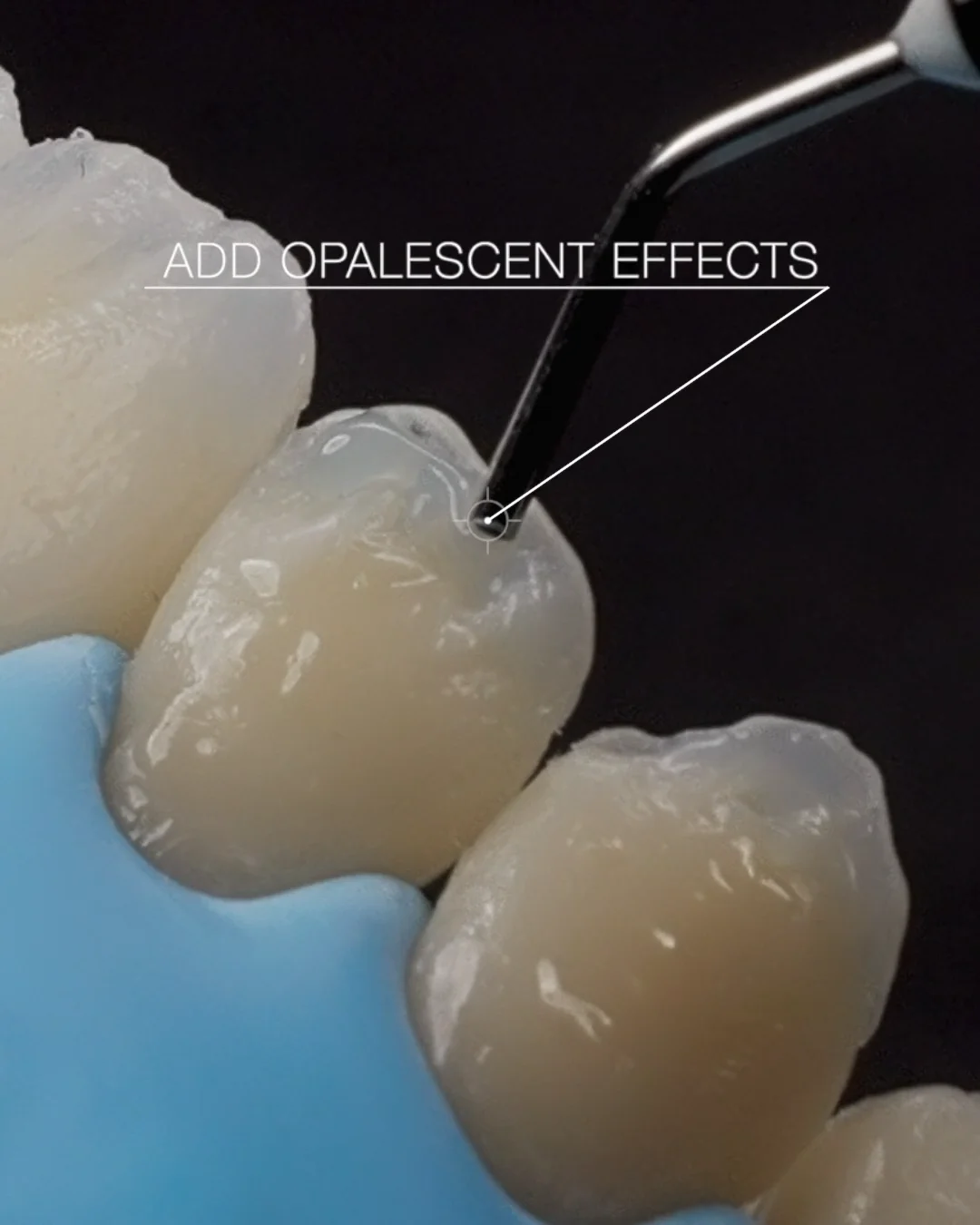 Renamel Microfill Flowable Opal Technique on Vimeo