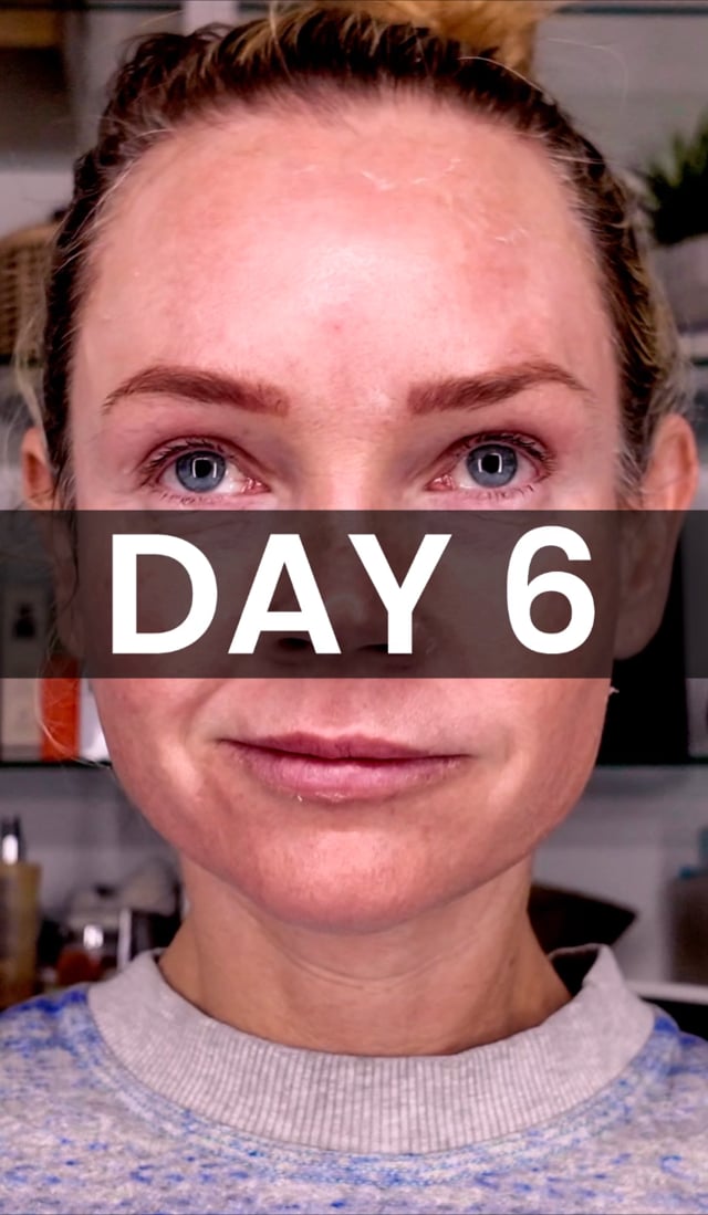TCA Peel: Day 6 Progress video