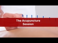 Massage Therapy: The Acupuncture Session