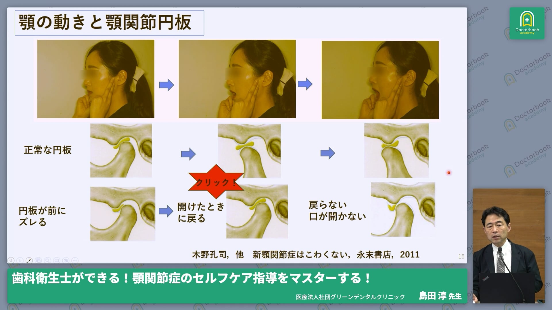 歯科衛生士にもできる顎関節症の診察、検査、治療法について解説