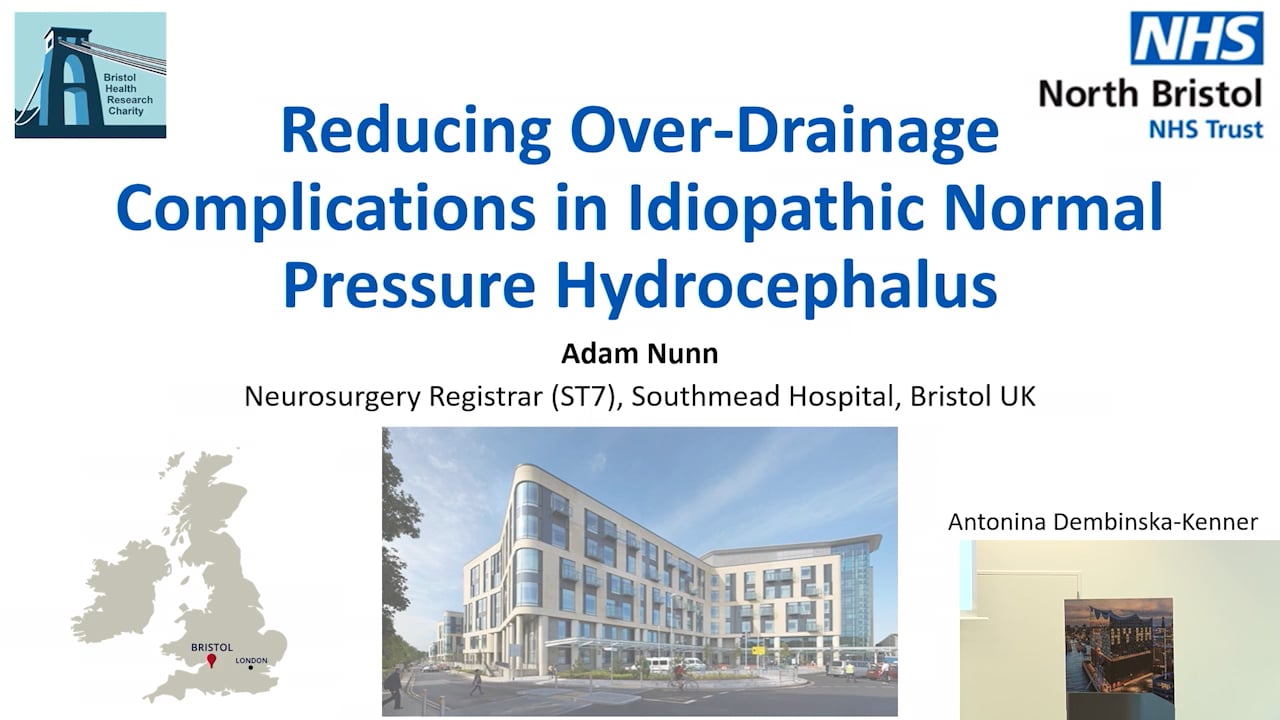 S23. Adam Nunn - Reducing Over-Drainage Complications in Idiopathic Normal Pressure Hydrocephalus