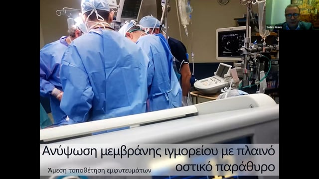 Ανοικτή ανύψωση ιγμορείου με πλαϊνό οστικό παράθυρο, υπολογιστικά καθοδηγούμενη και άμεση τοποθέτηση εμφυτευμάτων.