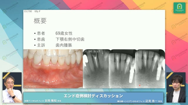 TOPIC2：無症候性不可逆性歯髄炎