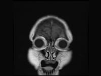 The Spider in My Brain