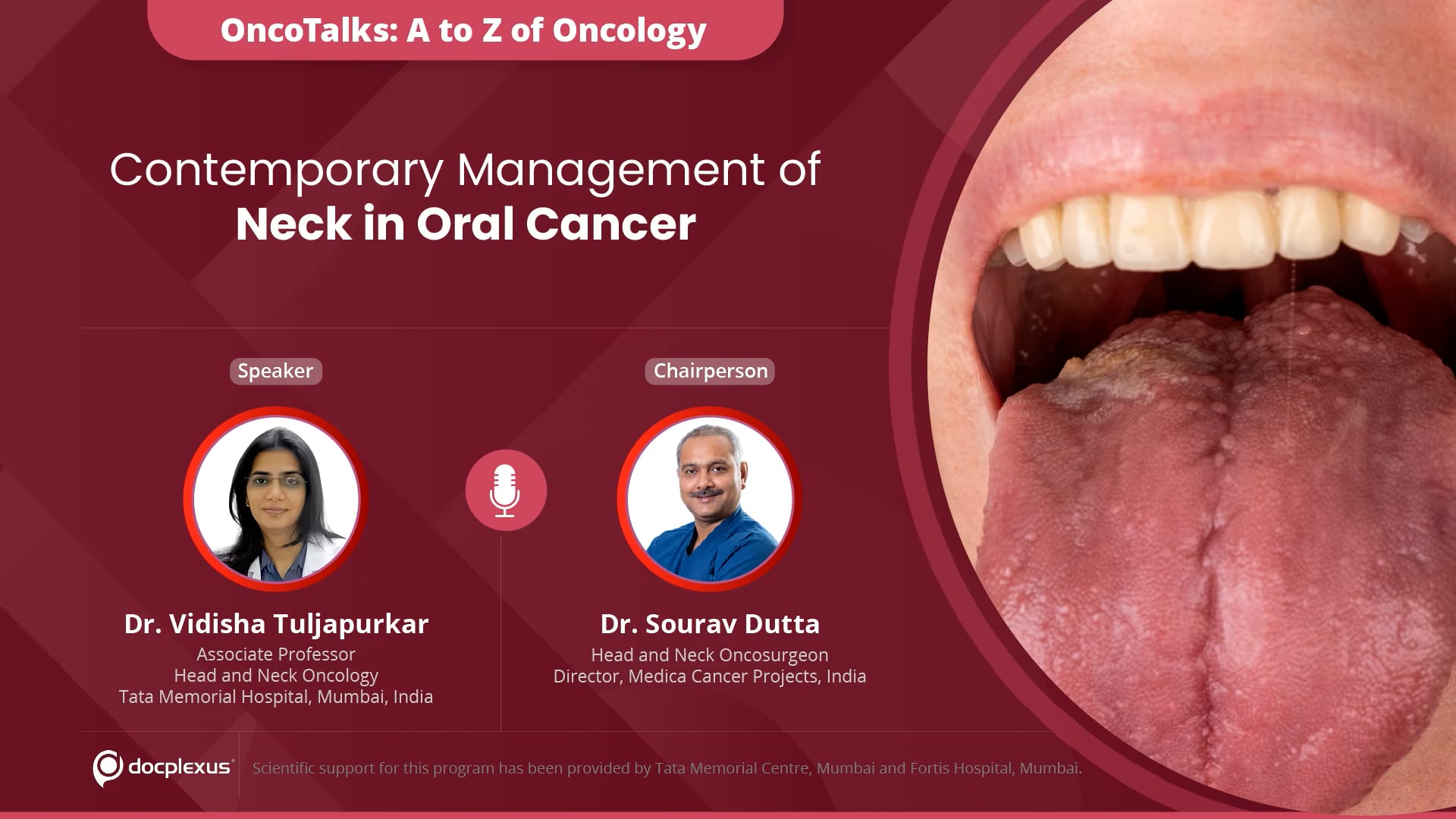 Contemporary Management of Neck in Oral Cancer
