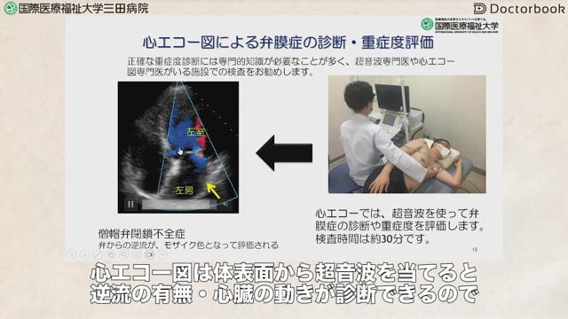 弁膜症の診断・治療