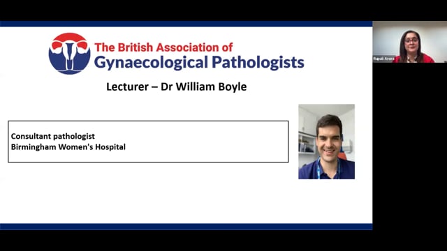 Case-based discussion: Ovarian case review, Dr Will Boyle