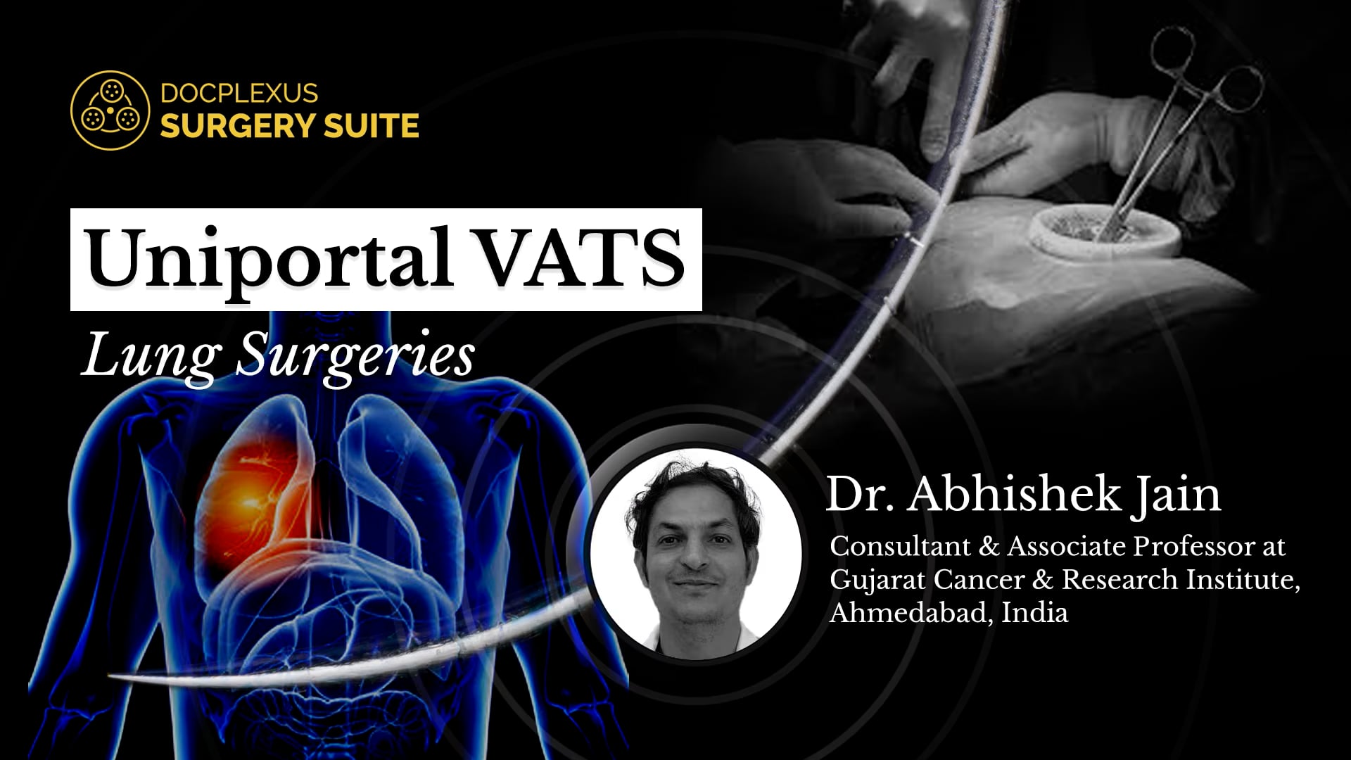 Uniportal VATS Lung Surgeries