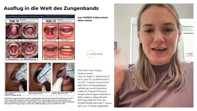 Lektion 4 - Zungenband Messschablone