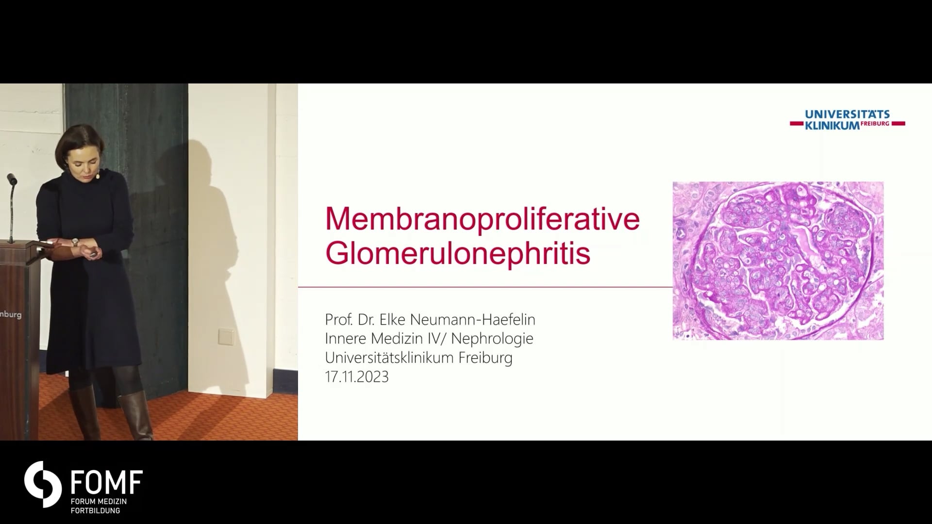 Membranoproliferative Glomerulonephritiden