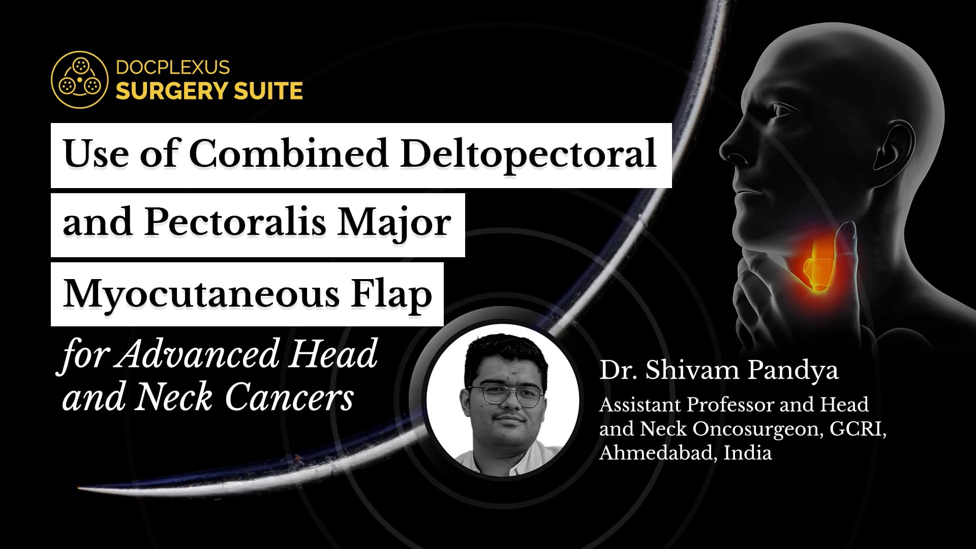 Use of Combined Deltopectoral and Pectoralis Major Myocutaneous Flap for Advanced Head and Neck Cancers