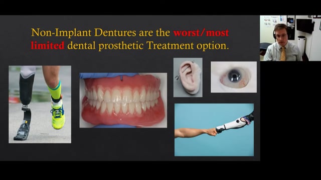 Webinar on SEMCD technique, Biofunctional Prosthetic System