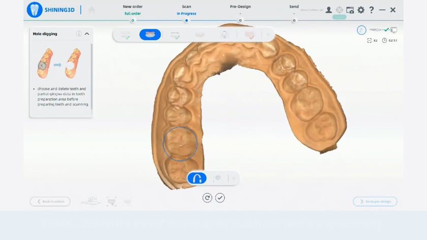 Shining® Quick Reference Videos - Dental Crafters