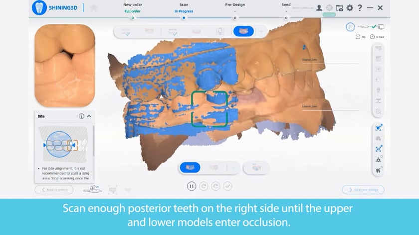 Shining® Quick Reference Videos - Dental Crafters