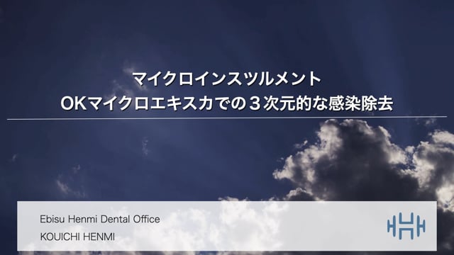 マイクロインスツルメントOKマイクロエキスカの3次元的感染除去｜辺見浩一先生(Archives)