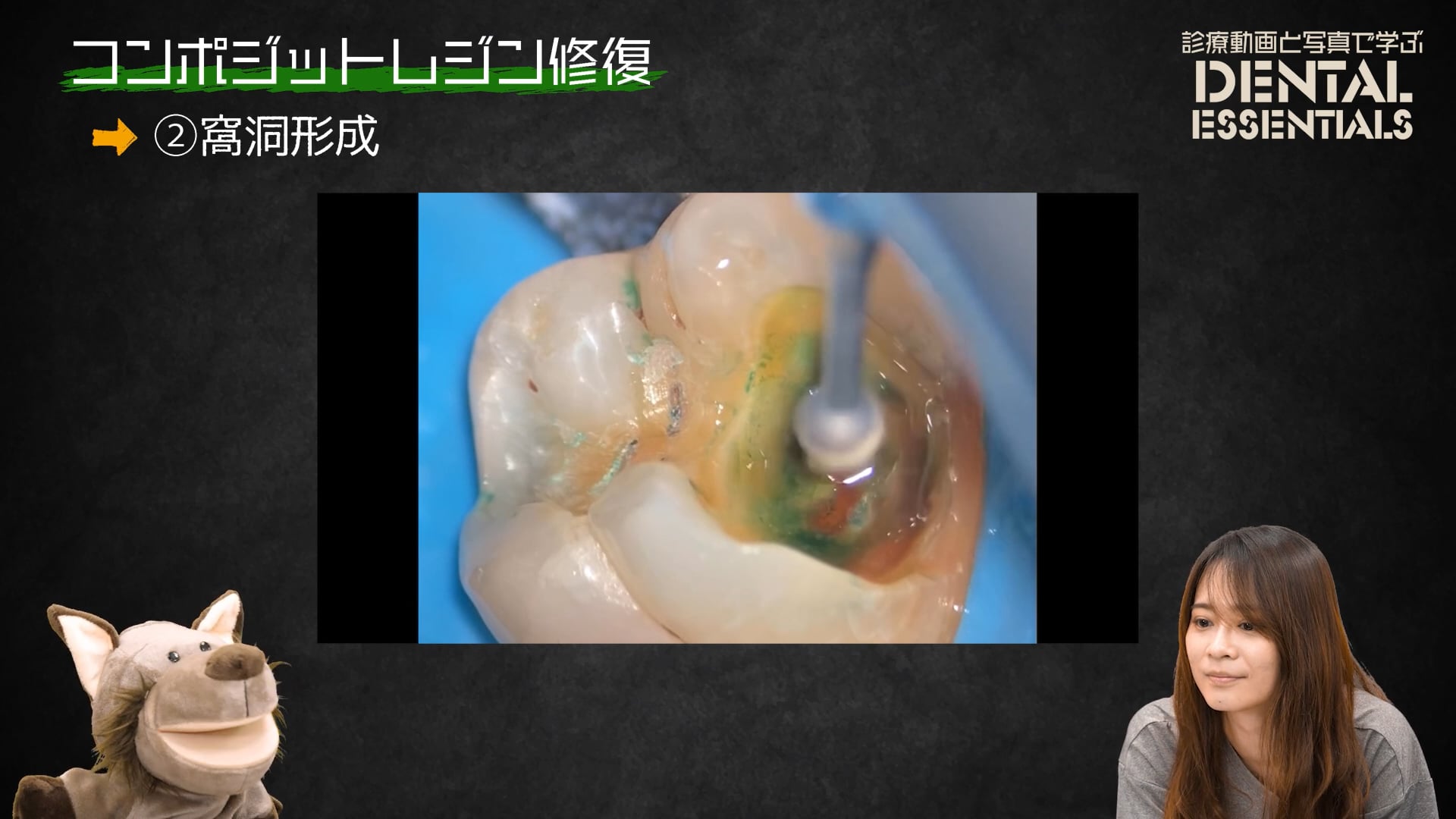 STEP2：窩洞形成│Dental Essentials vol.2 コンポジットレジン修復