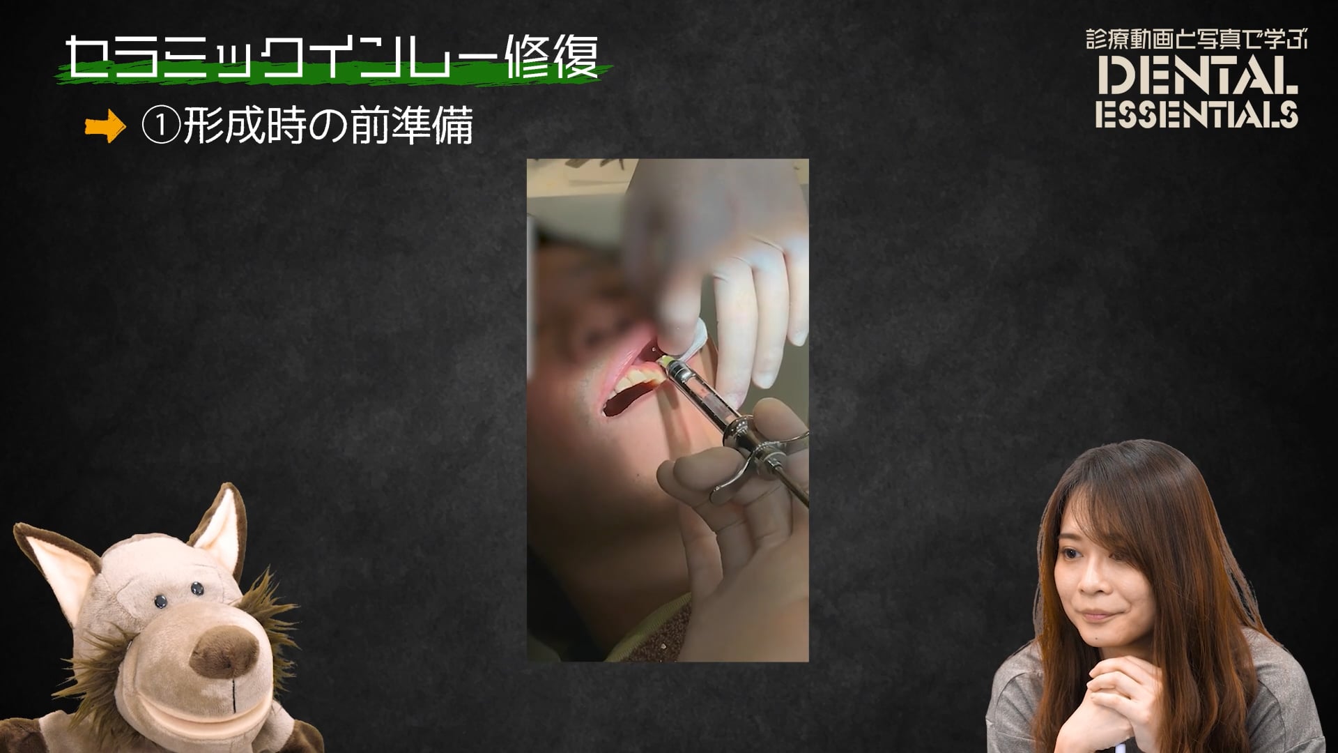 STEP1：形成時の前準備│Dental Essentials｜診療動画と写真で学ぶ vol.3 セラミックインレー修復