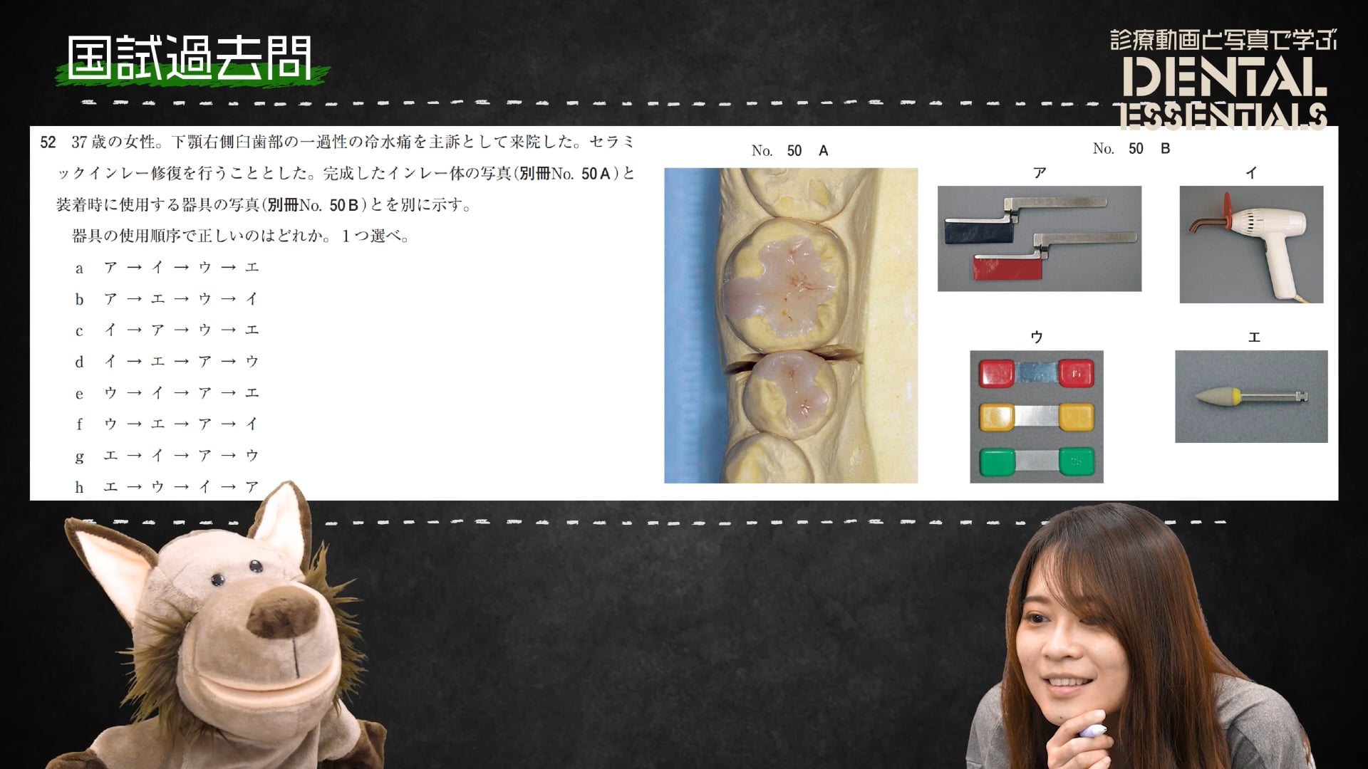 STEP7：国試過去問題│Dental Essentials vol.3 セラミックインレー修復