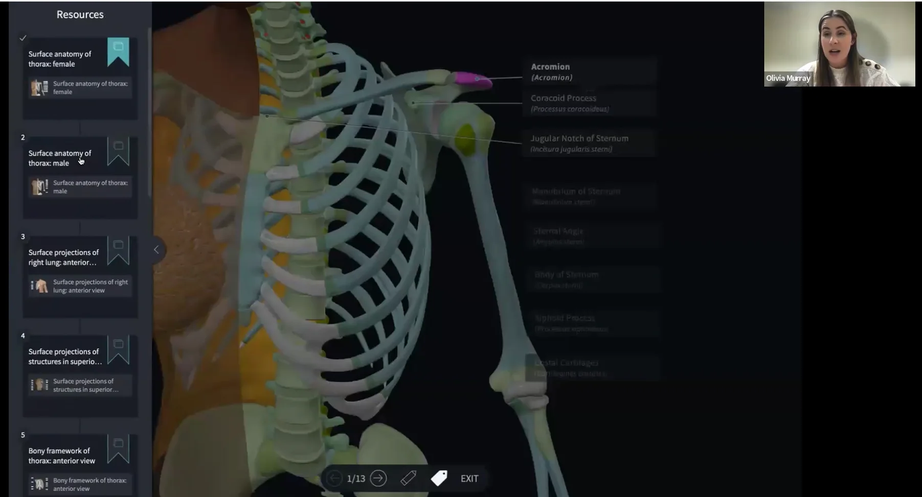 Complementing Dissection with Complete Anatomy on Vimeo