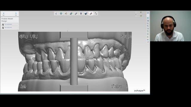 From planned case to final veneers: how to save time and optimize the ...