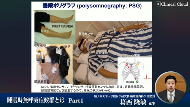 睡眠時無呼吸症候群〜治療の実際と課題〜　Part1