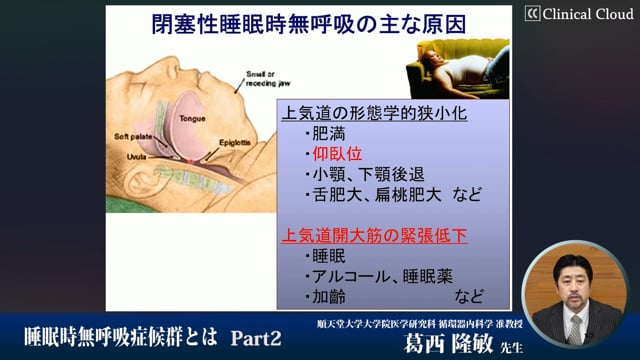睡眠時無呼吸症候群〜治療の実際と課題〜　Part2