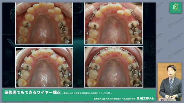 研修医でもできるワイヤー矯正 〜常勤Dr60人在籍する医療法人の内部セミナーを公開〜