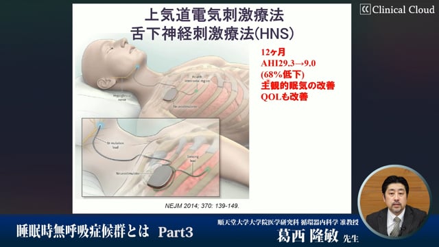 睡眠時無呼吸症候群とは　Part3