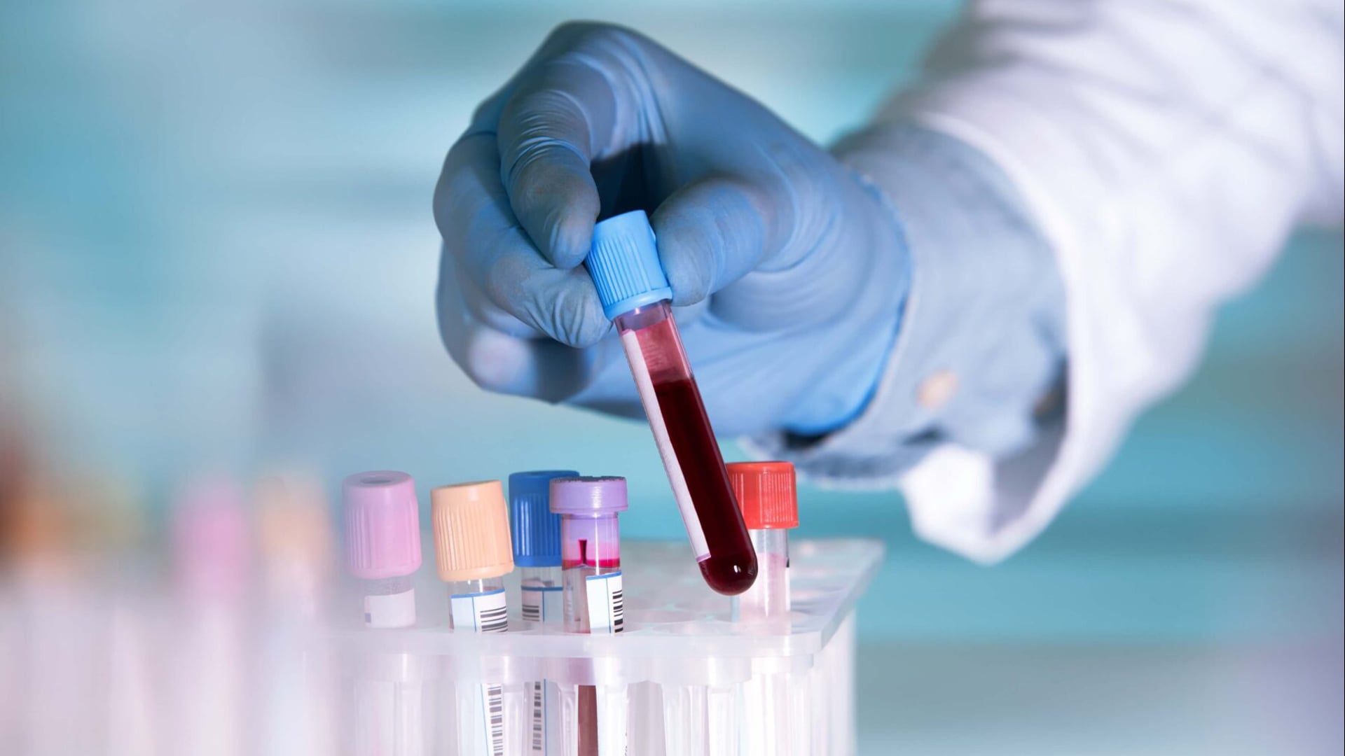 TRANSLATING SCIENCE INTO LIFE – Wyss Zurich