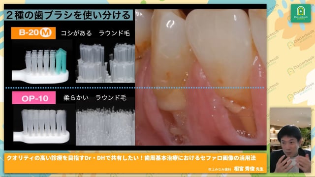 歯周基本治療におけるセファロ画像の活用法