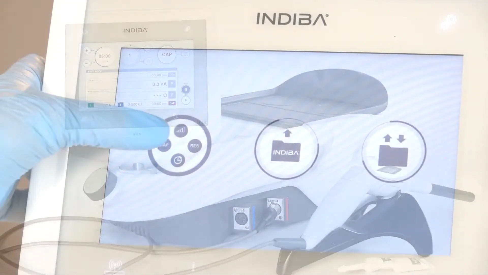 RGN - INDIBA Group (US)